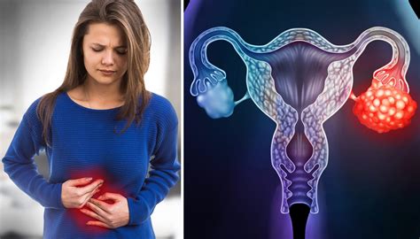 5 Signs That Could Mean Ovarian Cancer–Early Stages Are Hard to Detect, Here’s How