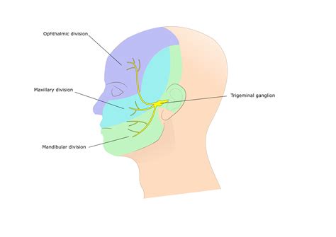 Trigeminal Neuralgia Treatment | Phoenix CyberKnife Center