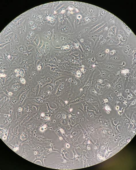 78 questions with answers in VERO CELLS | Scientific method