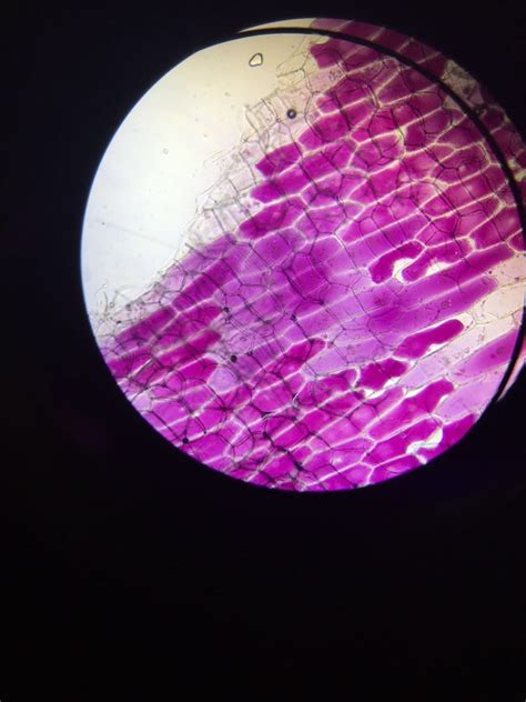 Plasmolysis of onion cells.