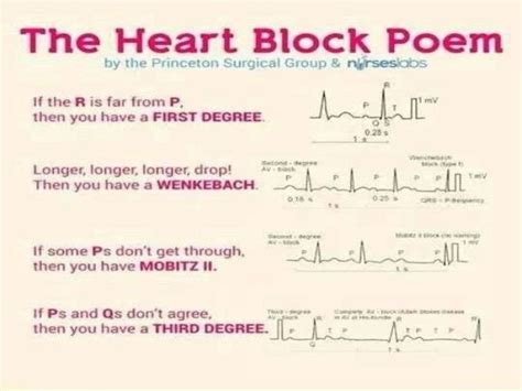 First Degree Heart Block / First degree heart block - YouTube - This appears as a regular rate ...