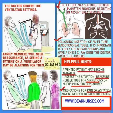 Dear Nurses: THE PATIENT ON MECHANICAL VENTILATION