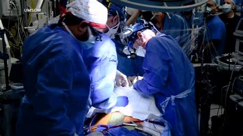 In 1st, US surgeons transplant pig heart into human patient - ABC7 Los ...