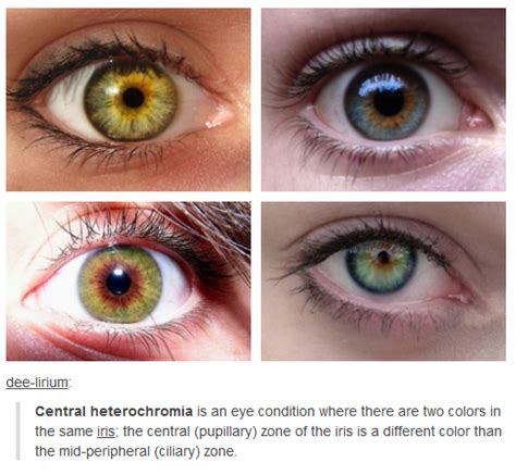 Central Heterochromia | Eye color facts, Eye color, Heterochromia