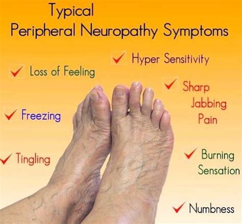 Peripheral Neuropathy / Sensory Loss | Symptoms of neuropathy, Peripheral neuropathy, Diabetic ...