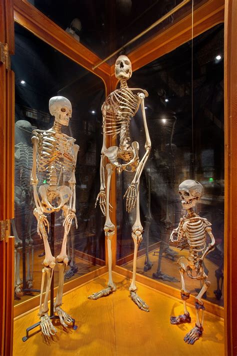 american_giant.jpg (2731×4096) (With images) | Mutter museum, Medical curiosities, Mütter museum