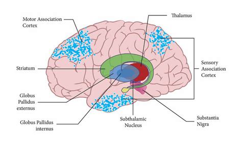 Corticobasal Degeneration - StoryMD