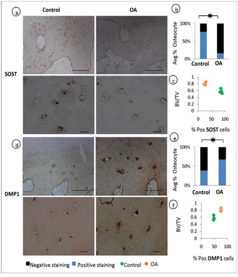 Phenotypic Characterization of Osteoarthritic Osteocytes from the Sclerotic Zones: A Possible ...