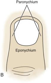 Perionychium | Musculoskeletal Key