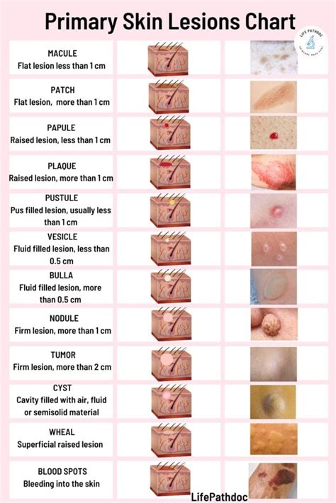 Skin Lesions Types