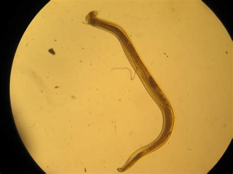 Ancylostoma duodenale - Microbiology Lab Notes