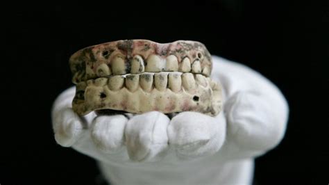 Forensic Odontology - Simplyforensic