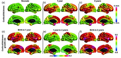 Mean cortical thickness and cortical thickness growth in the first 2 ...