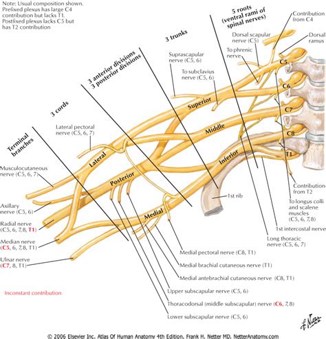 Brachial Plexus Neuritis; Amyotrophy, Neuralgic; Cervico-Brachial Neuralgia; Neuralgia ...