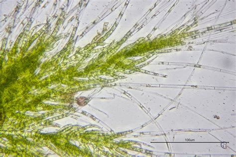 Cladophora | The Microscopic Life of Shetland Lochs