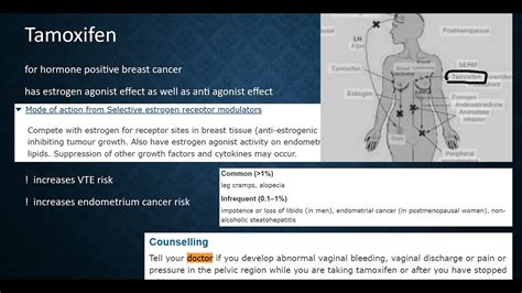 Tamoxifen, SERM, breast cancer, OSCE pharmullary, OSCE, counselling, Roze Pharm - YouTube