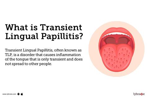 Transient Lingual Papillitis: Causes, Symptoms, Treatment and Cost