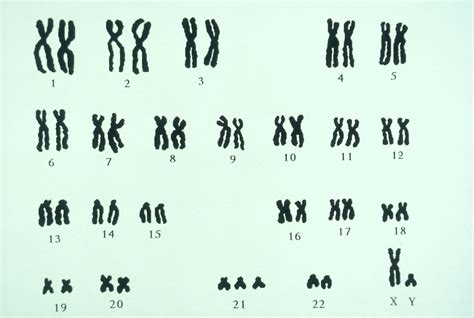 Karyotype chart and Chromosome anatomy Diagram | Quizlet