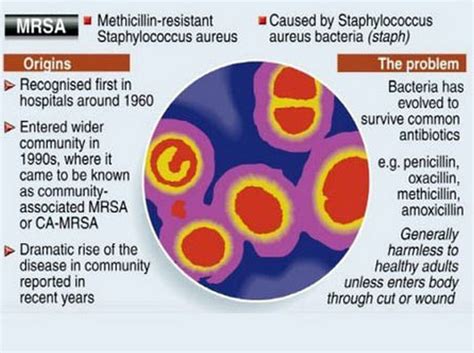 MRSA and VRE=Types of Hospital Acquired Resistant Infections | Strive For Good Health