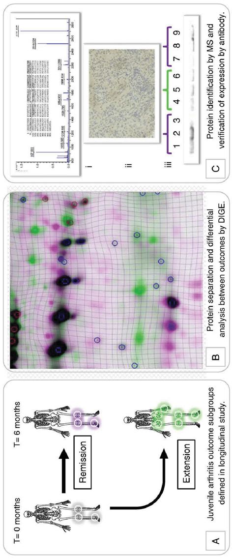 Proteomic strategy to discover biomarkers which stratify patients by... | Download Scientific ...