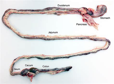 Image Gallery: Autopsy for the General Practitioner | Clinician's Brief