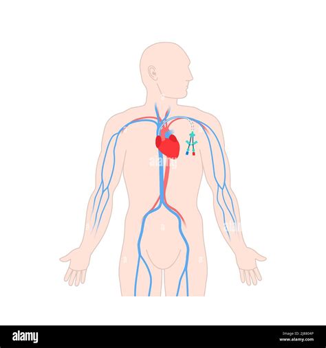 Central venous catheter, illustration Stock Photo - Alamy