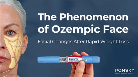 Ozempic Face Changes | Dr. Diana Ponsky Facial Plastic Surgery