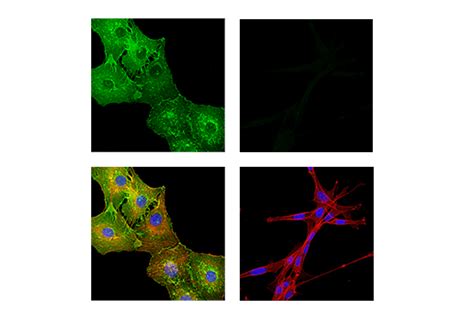 Myelin Protein Zero Antibody | Cell Signaling Technology