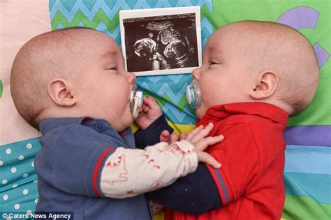 Identical twins pictured cuddling each other in the womb | Daily Mail Online