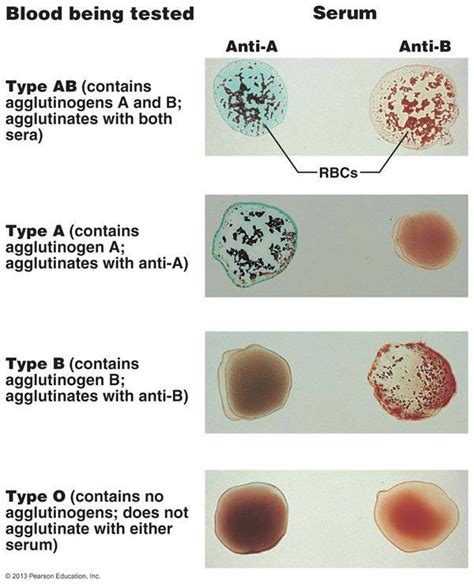 Blood Group Typing Slide Method | Medical Laboratories