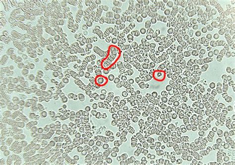 Reading Blood under a microscope - Biology Forum | Biology-Online Dictionary, Blog & Forum