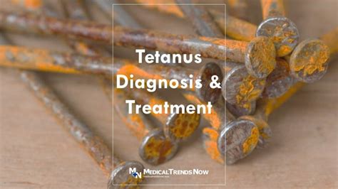 Best Diagnosis and Treatment for Tetanus in the Philippines – Medical ...