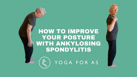 Quick tips to improve your posture with Ankylosing Spondylitis