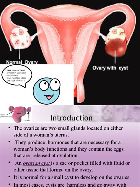 Ovarian Cyst | Ovarian Cancer | Ovary