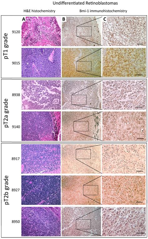 Representative light microscopy pictures of staining of B lymphoma ...