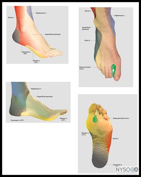 Ankle Block - NYSORA The New York School of Regional Anesthesia