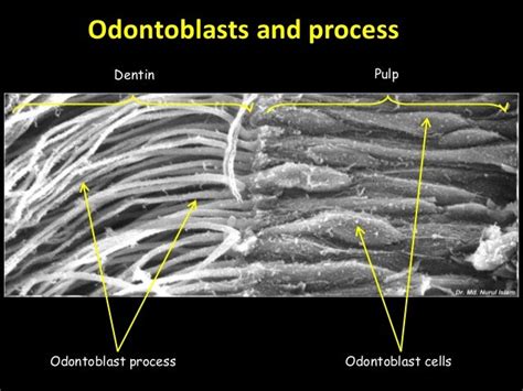 dentin pattern of mineralization, 1ry 2nd 3ry dentin formation and ro…