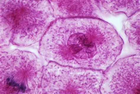 Early prophase of mitosis, LM - Stock Image - P673/0069 - Science Photo Library