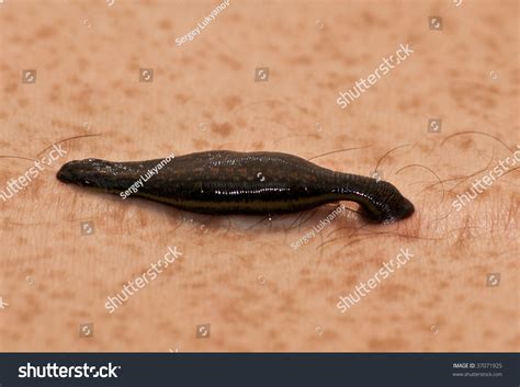 Photo Of Leech Sucking Blood From Human - 37071925 : Shutterstock