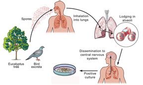 Psittacosis | India| PDF | PPT| Case Reports | Symptoms | Treatment