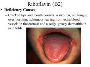 Benefits of Vitamin B2 riboflavin – Holistic Nutrition is a ...