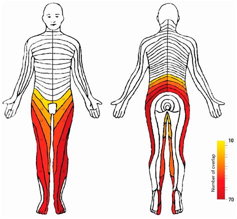 Cervical Radiculopathy Dermatomes