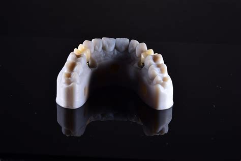 Dental Implants | Melbourne Implant Professionals