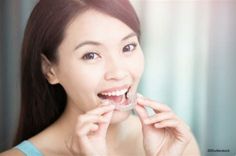 Straight Talk: Invisalign® | Corsa Orthodontics