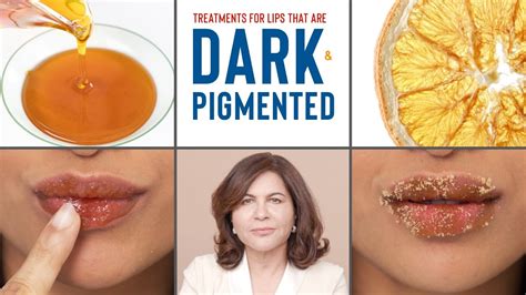 How To Treat DARK, PIGMENTED Lips | Dermatologist's Advice - YouTube