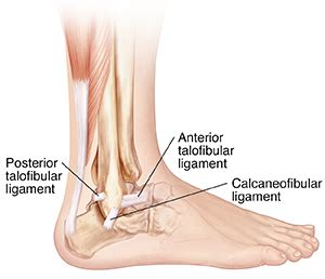 Understanding Lateral Ankle Ligament Reconstruction | Saint Luke's ...