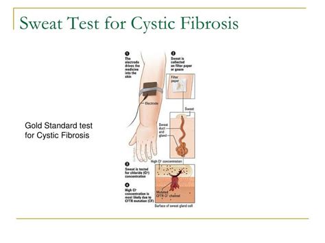 PPT - Respiratory Assessment PowerPoint Presentation - ID:1185666