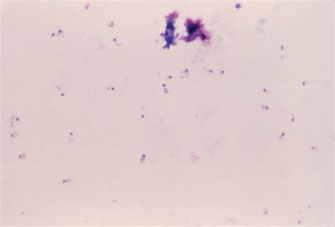 Free picture: thick, blood smear, photomicrograph, comma, shaped, plasmodium falciparum, parasite