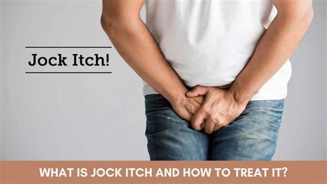 Jock Itch (Tinea Cruris) Causes Symptoms Diagnosis, 45% OFF