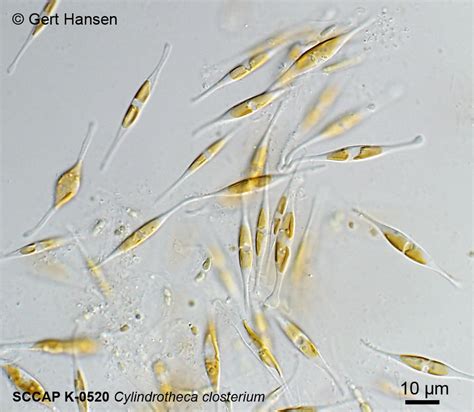 Diatoms - Protists